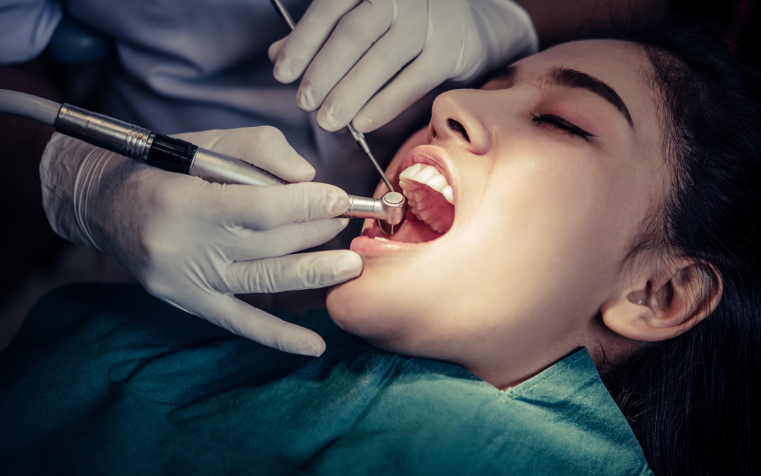 Il Dottor Diego Cappi spiega come trattare un dente cariato.