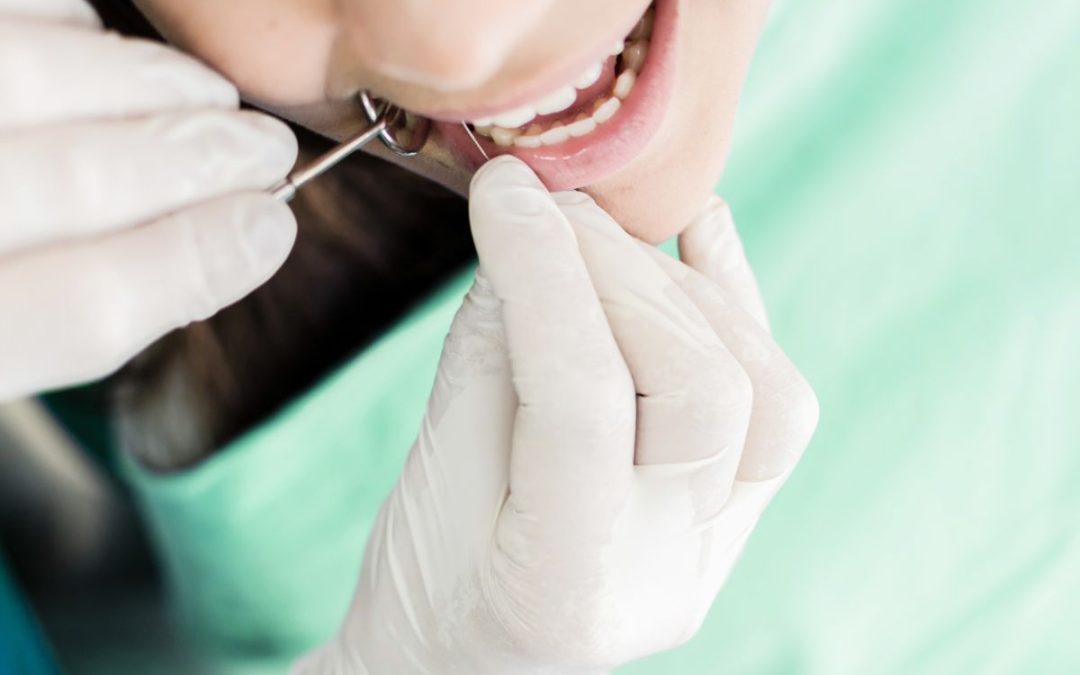 Denti devitalizzati, come prendersene cura
